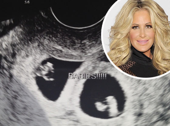 Kim Zolciak, Sonogram Kim Zolciak, Sonogram